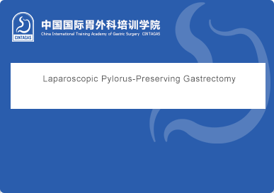 Laparoscopic Pylorus-Preserving Gastrectomy