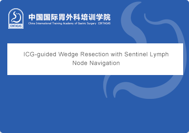 ICG-guided Wedge Resection with Sentinel Lymph Node Navigation
